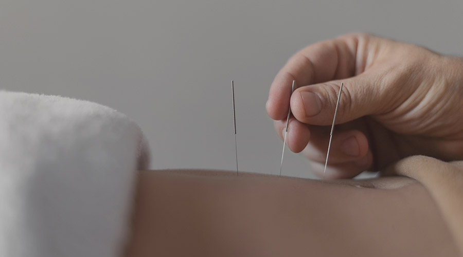 Acupuncture - The Well Medical Clinic
